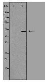 TESK1 Antibody