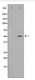 PSEN1 Antibody