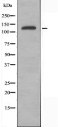 NACAD Antibody