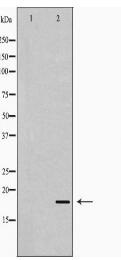 STMN1 Antibody