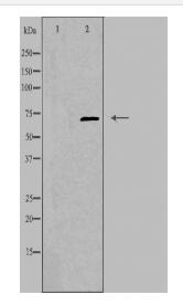 TROVE2 Antibody