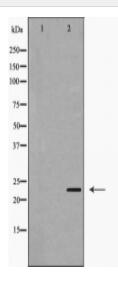 PPP1R2 Antibody