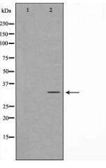 MAST4 Antibody