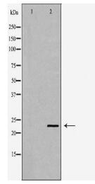 RBP4 Antibody