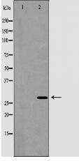 Cathepsin G Antibody