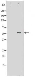 KCNA1 Antibody