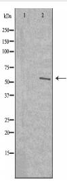 TMEM145 Antibody