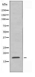 UBE2D2 Antibody