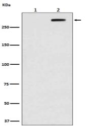 Phospho-ATM (S1981) Antibody