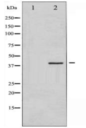 eIF2 alpha Antibody