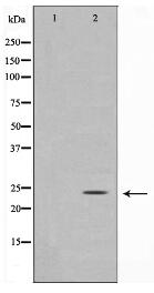 Glucagon Antibody