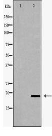 VEGFB Antibody