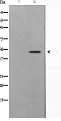 SKP2/p45 Antibody