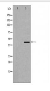 Dematin Antibody