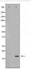 Stathmin 1 Antibody