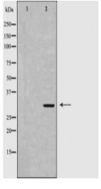 MTAP Antibody