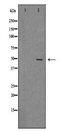 IDH1 Antibody