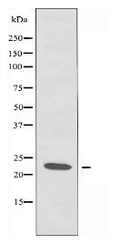 RCAN1 Antibody