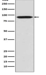 Bcl-6 Antibody