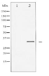 C/EBP-beta Antibody