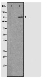 IGF1R Antibody