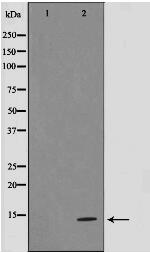 TIMP4 Antibody