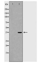 THPO Antibody