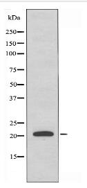 STMN3 Antibody