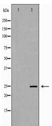 PRG2 Antibody