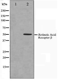 Retinoic Acid Receptor beta Antibody