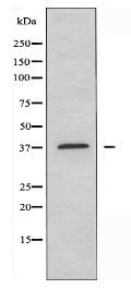 HTR5B Antibody