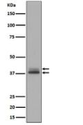 Phospho-Erk1 (T202/Y204) + Erk2 (T185/Y187) Antibody