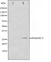 Galectin 3 Antibody