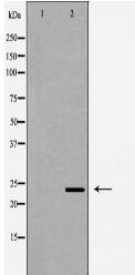 RGS2 Antibody