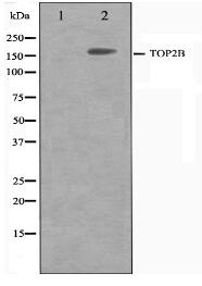 TOP2B Antibody