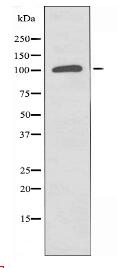 RANBP17 Antibody