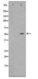 MMP10 Antibody