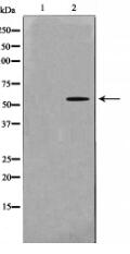 MAPKAPK5 Antibody