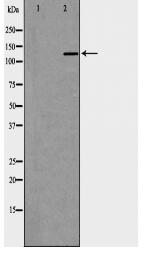 IRS1 Antibody