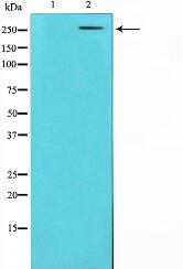 Factor VIII Antibody