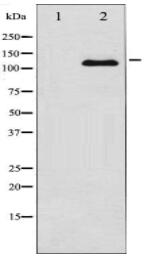 JAK2 Antibody