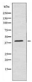 VPS72 Antibody