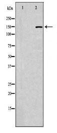 PLCG2 Antibody