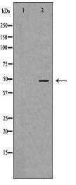 KCNN4 Antibody