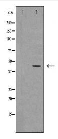 UTS2R Antibody