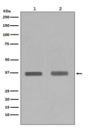 PPP1CA+PPP1CB Antibody