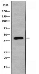 RAD51L1 Antibody