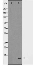 S100 A10 Antibody