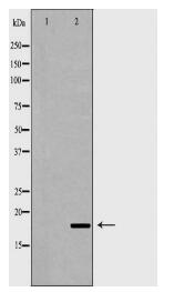 UBE2I Antibody