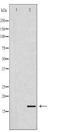 UBE2D1 Antibody